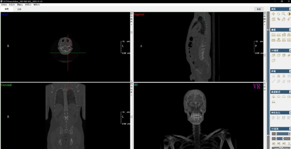 DCTViewer,CT,查看.